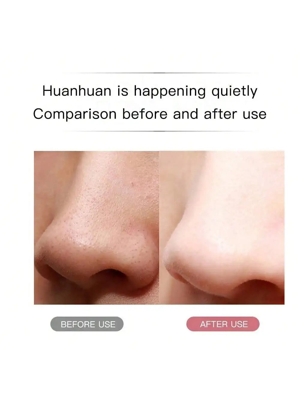 Épurateur de peau à ultrasons